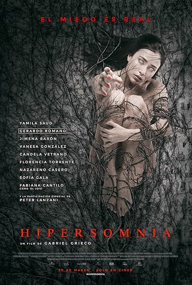 Hipersomnia
