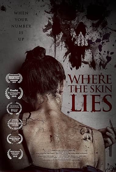 Where the Skin Lies
