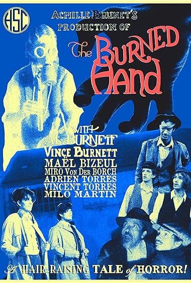 The Burned Hand