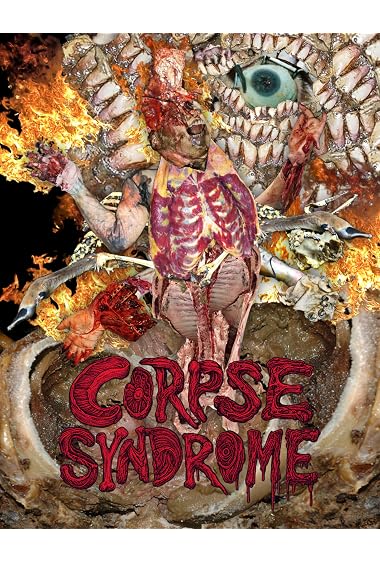 Corpse Syndrome